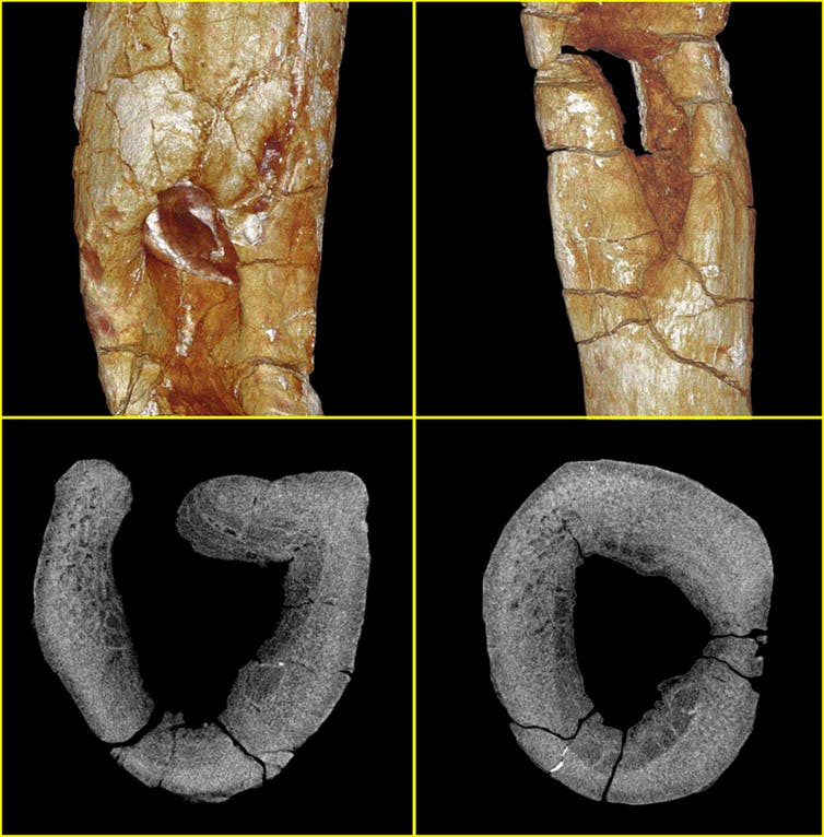 Micro-computed tomography allowed us to produce surface renderings of the fossil in 3D (top row) and 2D X-ray slices through the rib (bottom row). These show areas of cellular reorganisation, bone destruction and bone formation indicative of ostemyelitis. Patrick Randolph-Quinney, UCLan