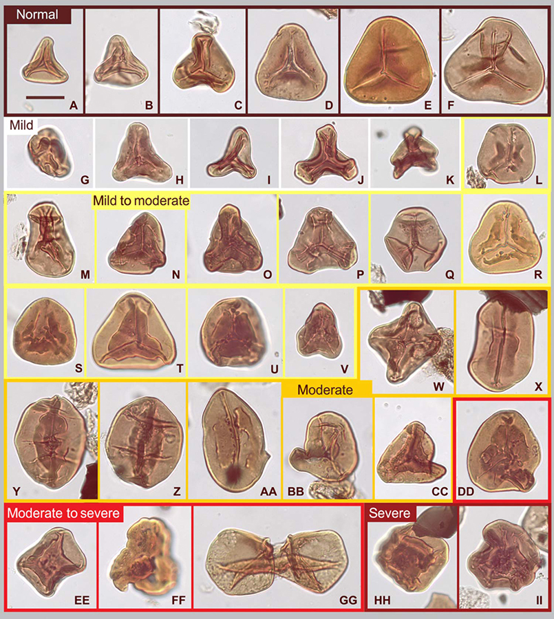 Normal and mutated fern spores from the end-Triassic mass extinction. Scale bar – 20 μm. Image credit: Sofie Lindström, Geological Survey of Denmark and Greenland.